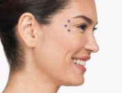 botox skin care