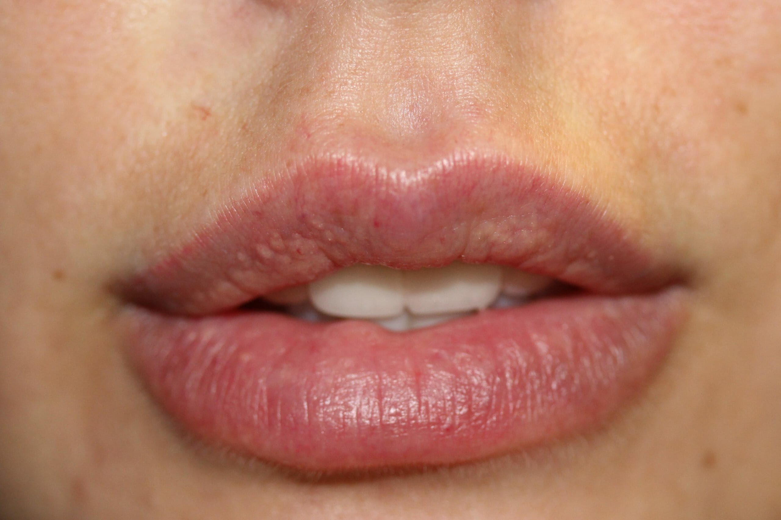 Lips Before scaled