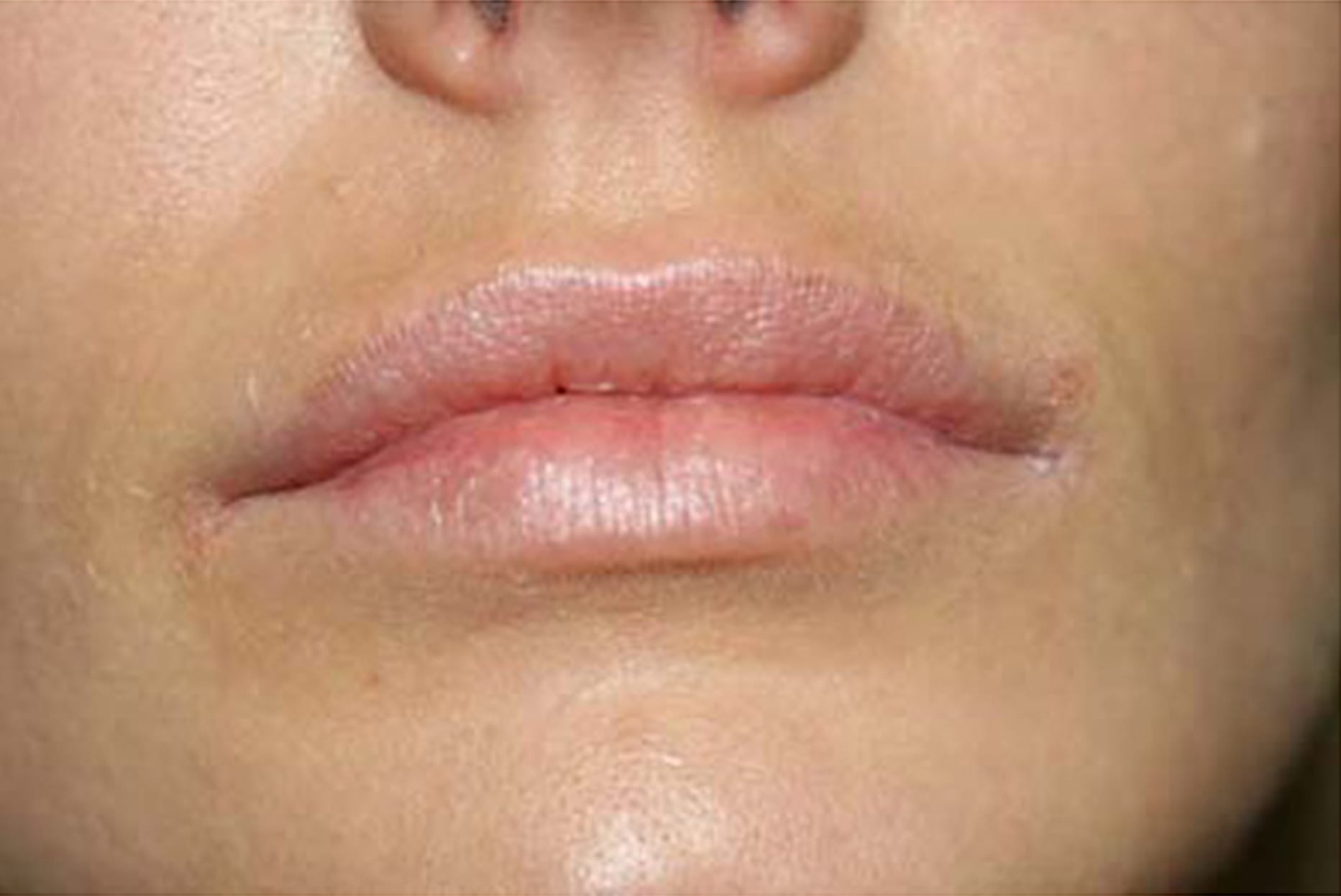 Lips Before Ruth Swissa