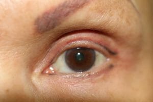 Correction Eyeliner 300x200