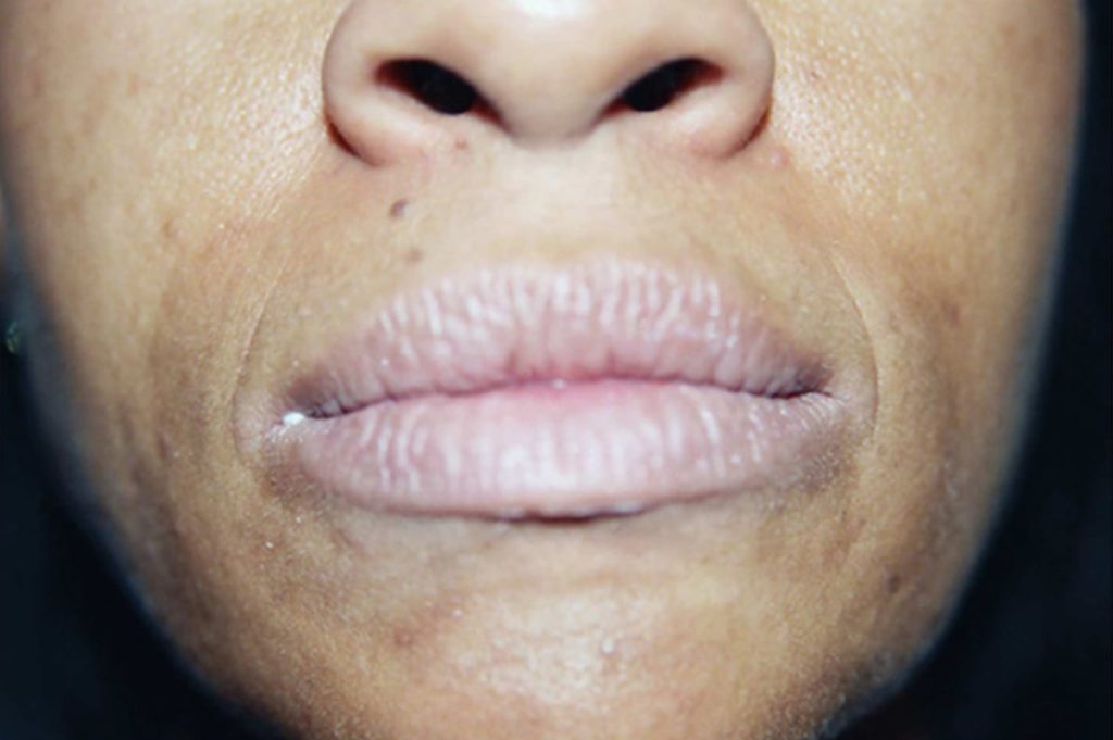 Lip Blush