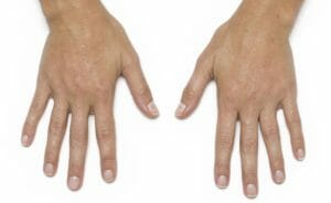hands leanne after