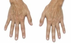 hands leanne before