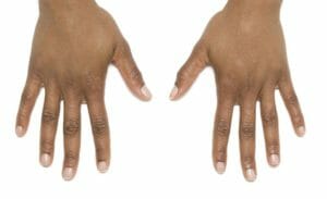 hands zondra after