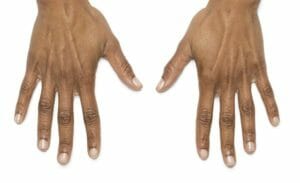 hands zondra before