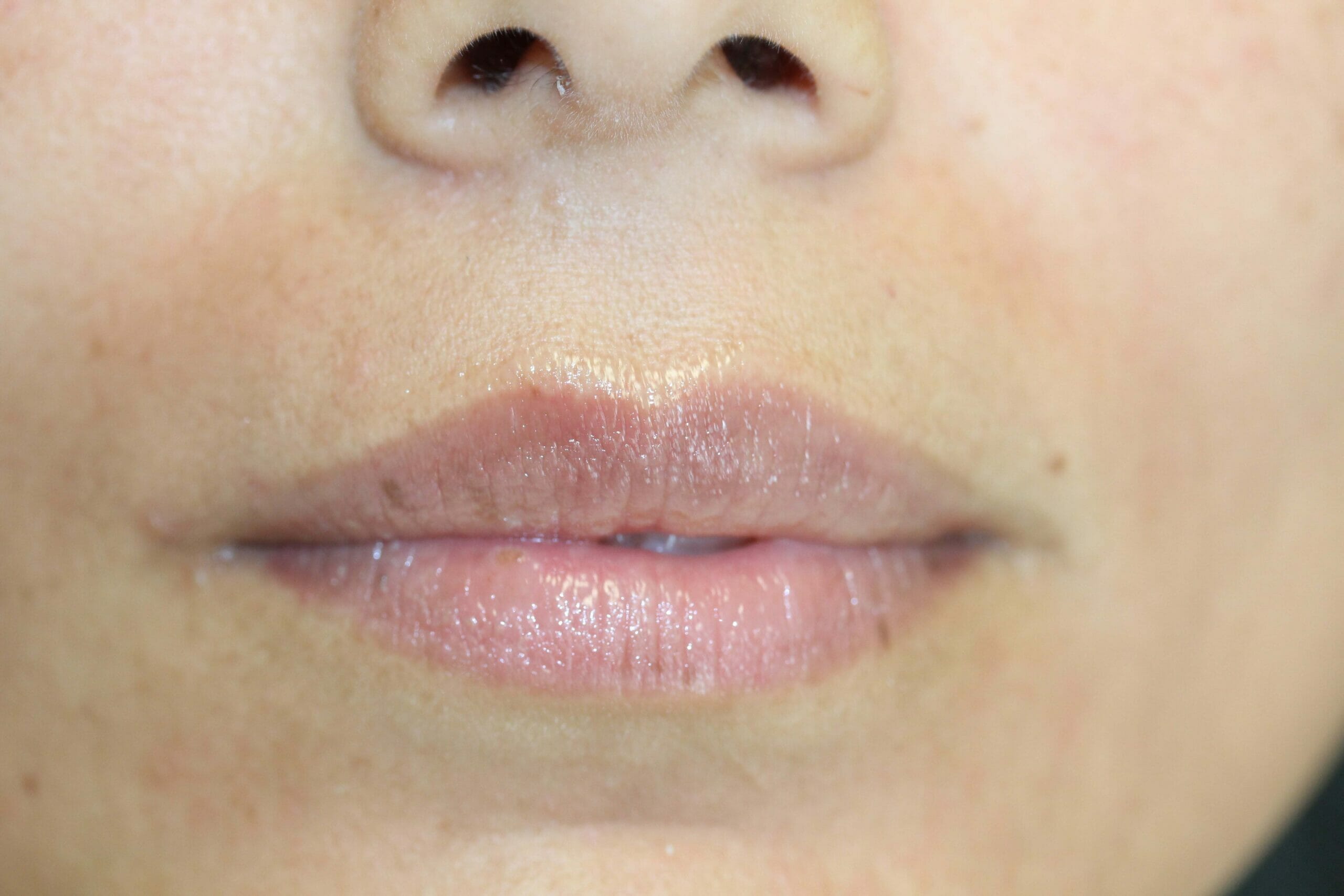 Permanent Lip Liner Color After Treatment