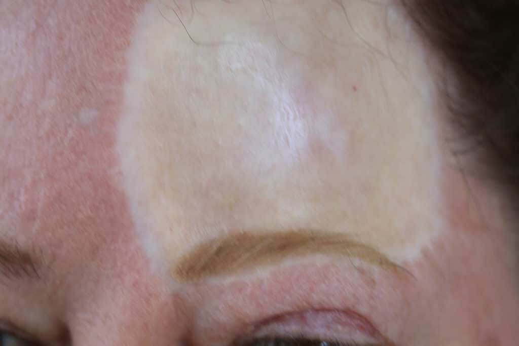 Permanent Makeup Before and After Pictures