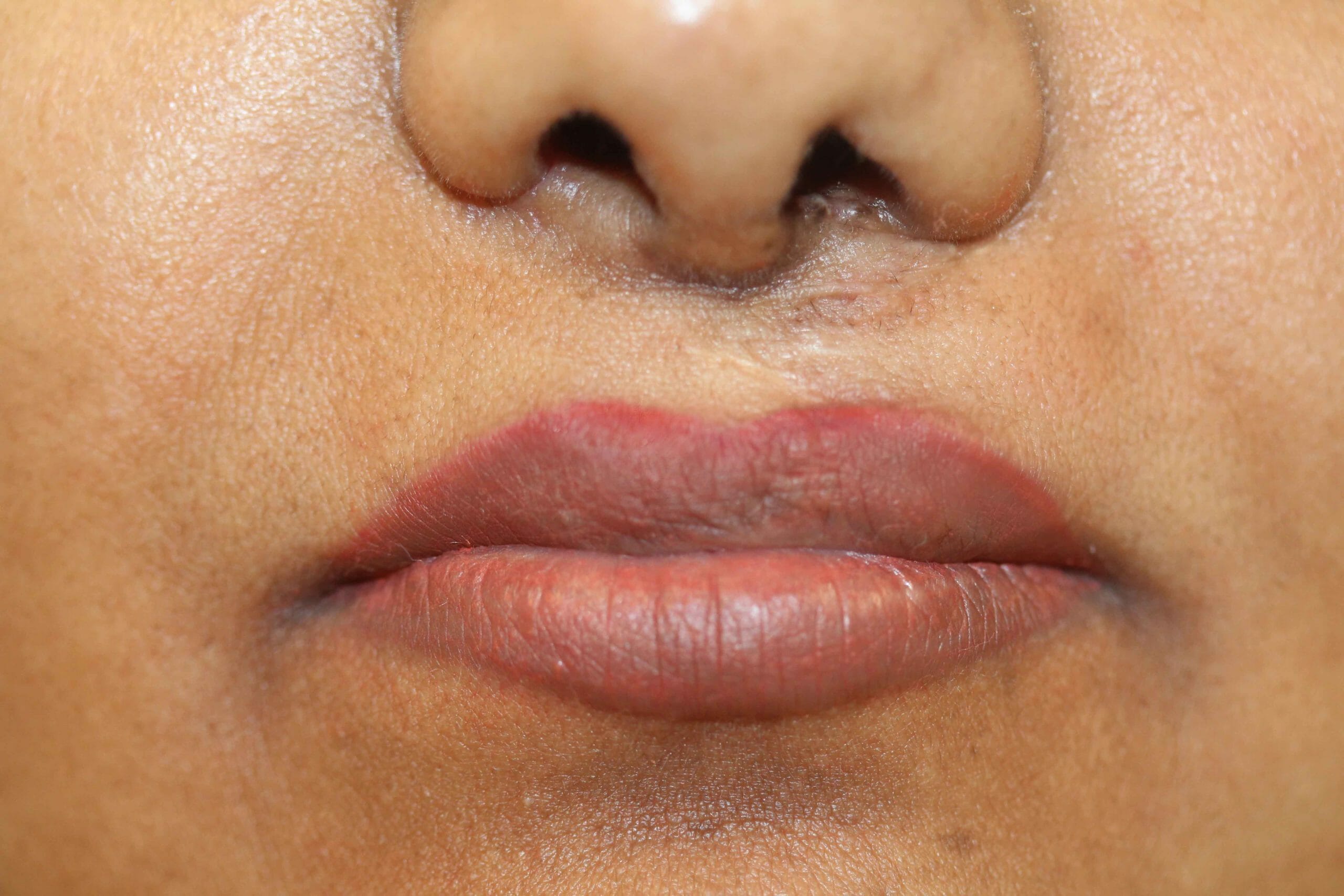 Permanent Lip Liner Color After Treatment
