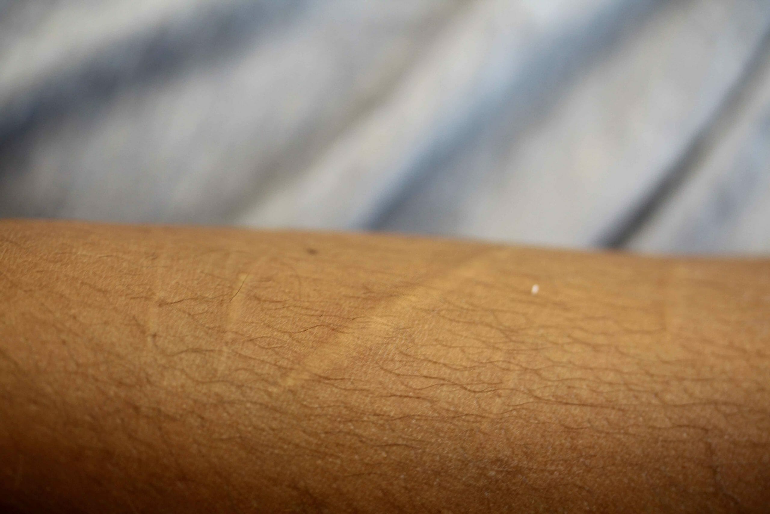 Scar Camouflage Image