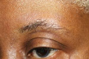 Eyebrow Hair Stages
