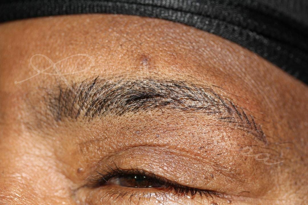 Permanent Eyebrows Before and After