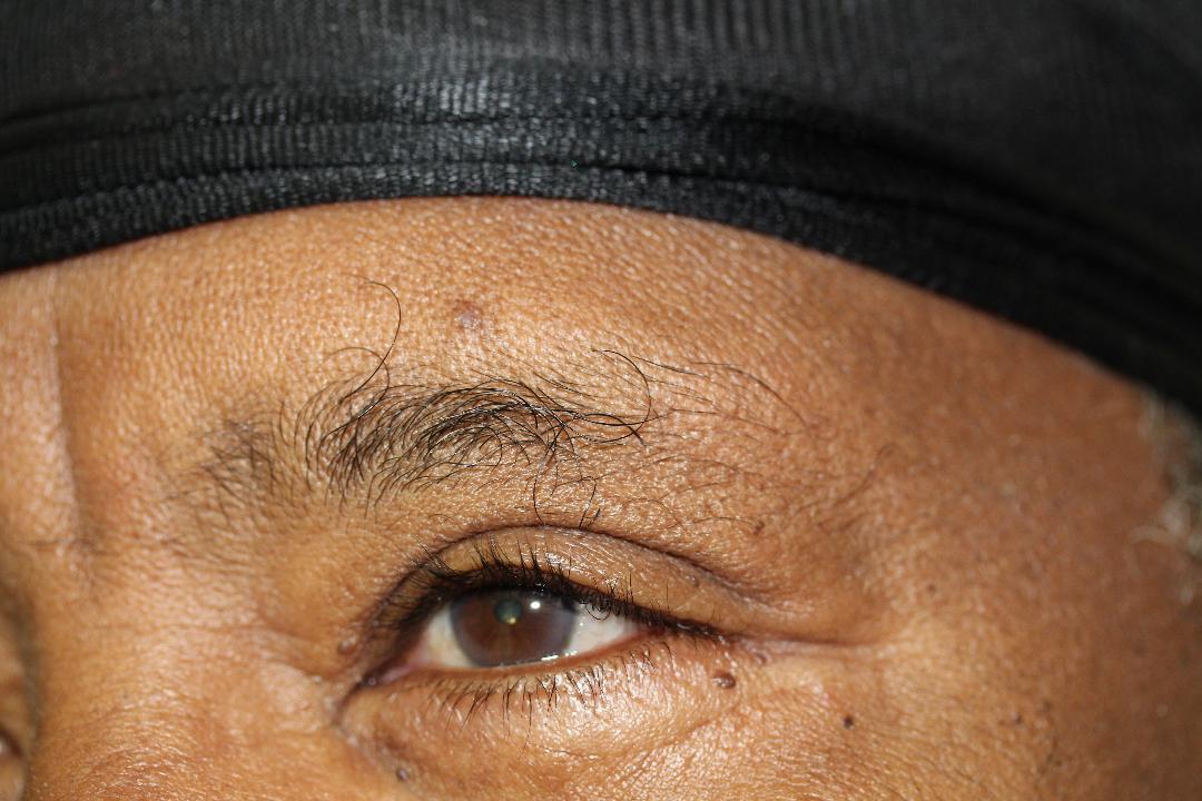 permanent eyebrows