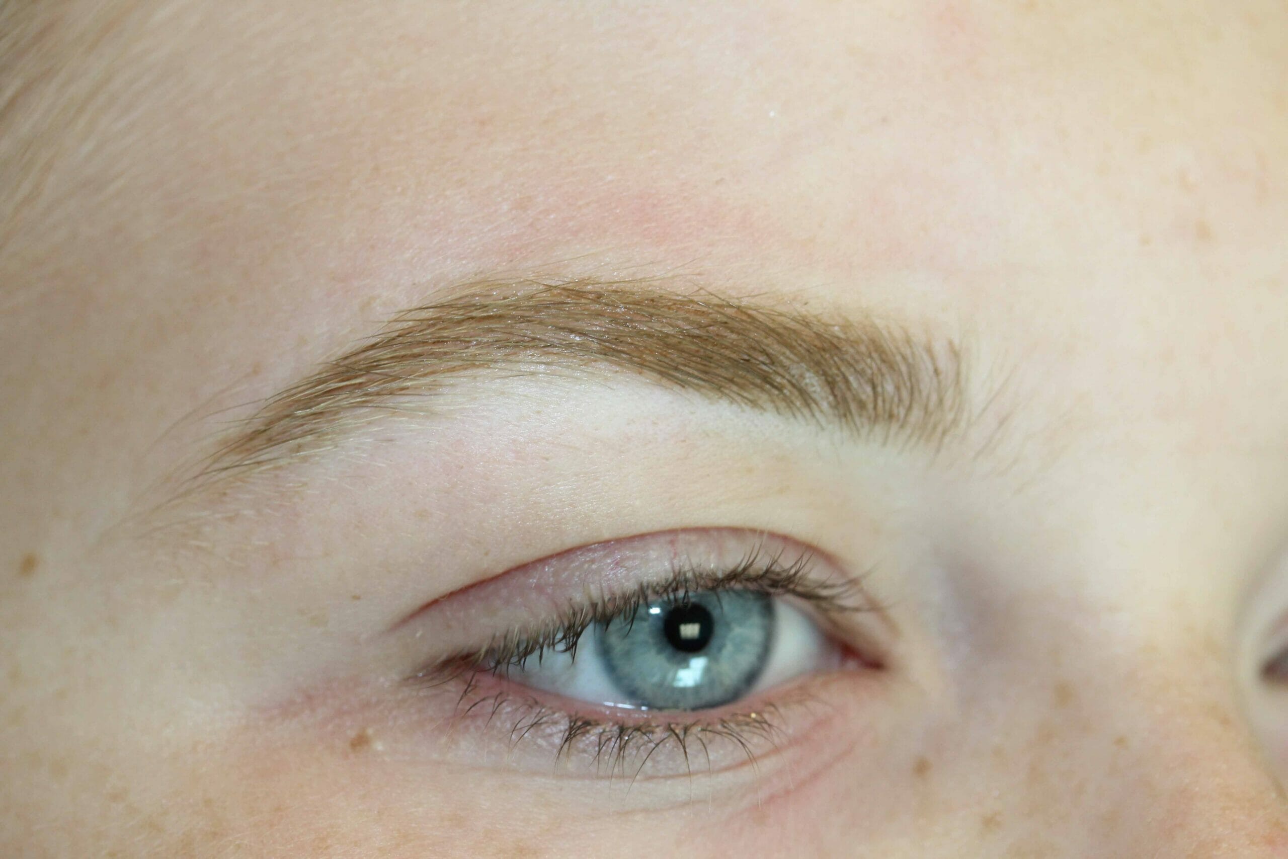 Eyebrow After Scaled Photo