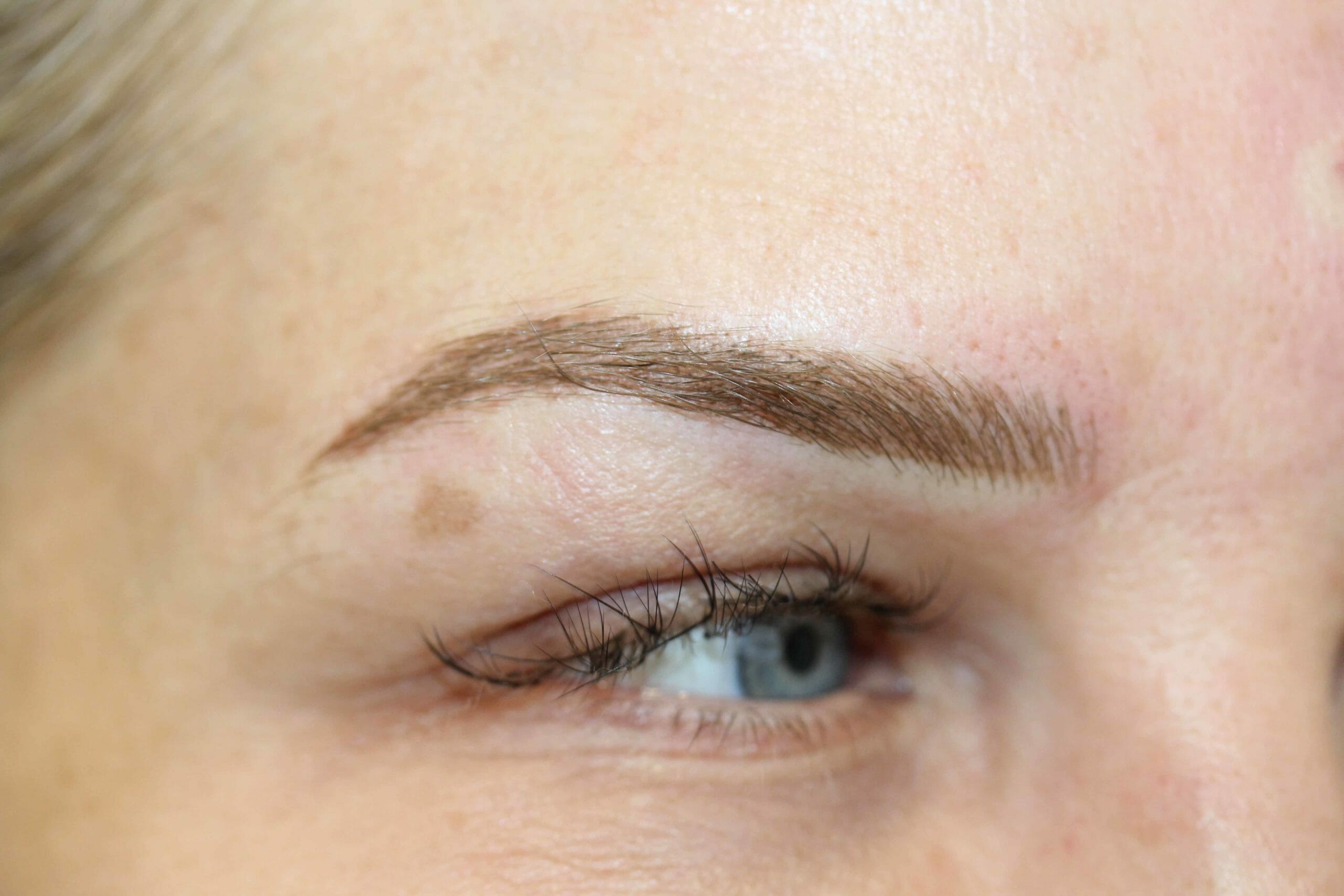 Eyebrow After Scaled