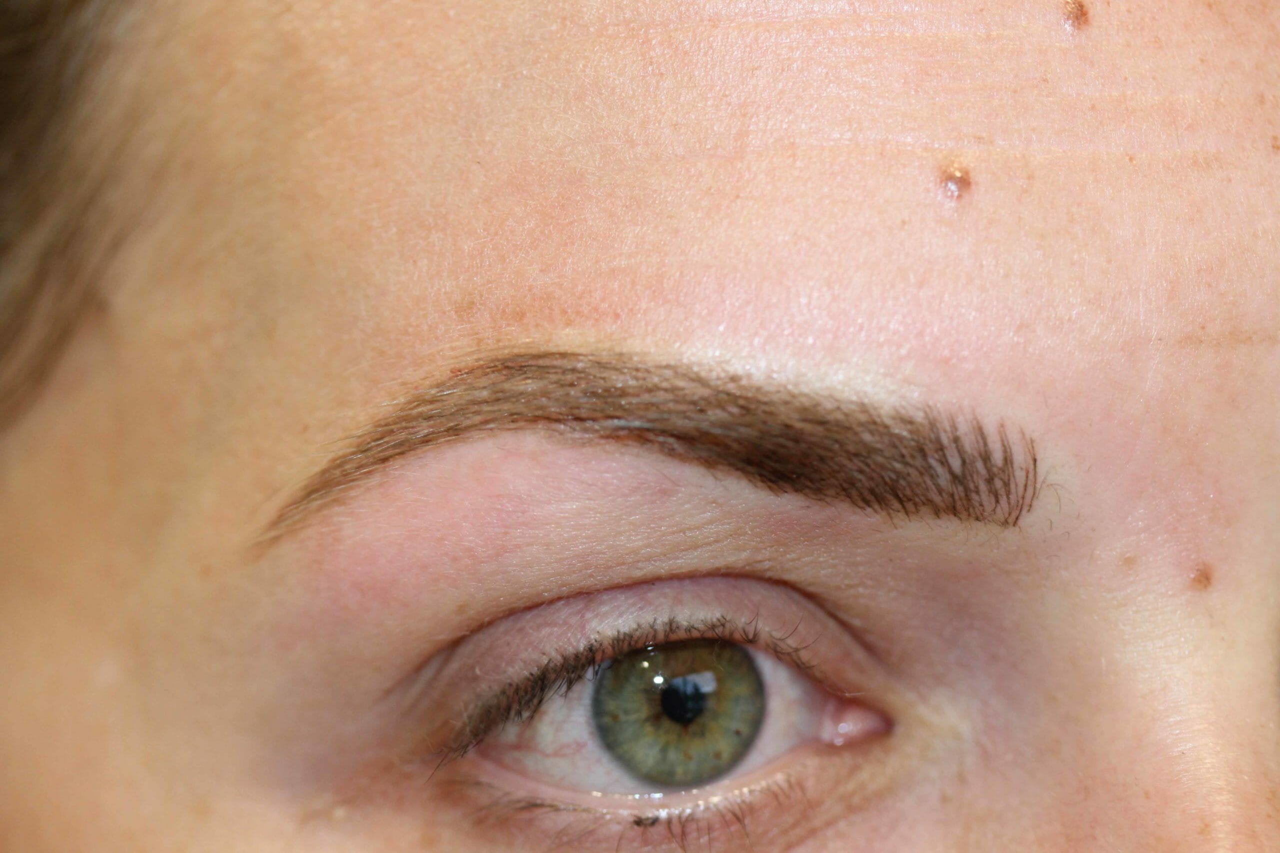 After & Before Eyebrow After Scaled