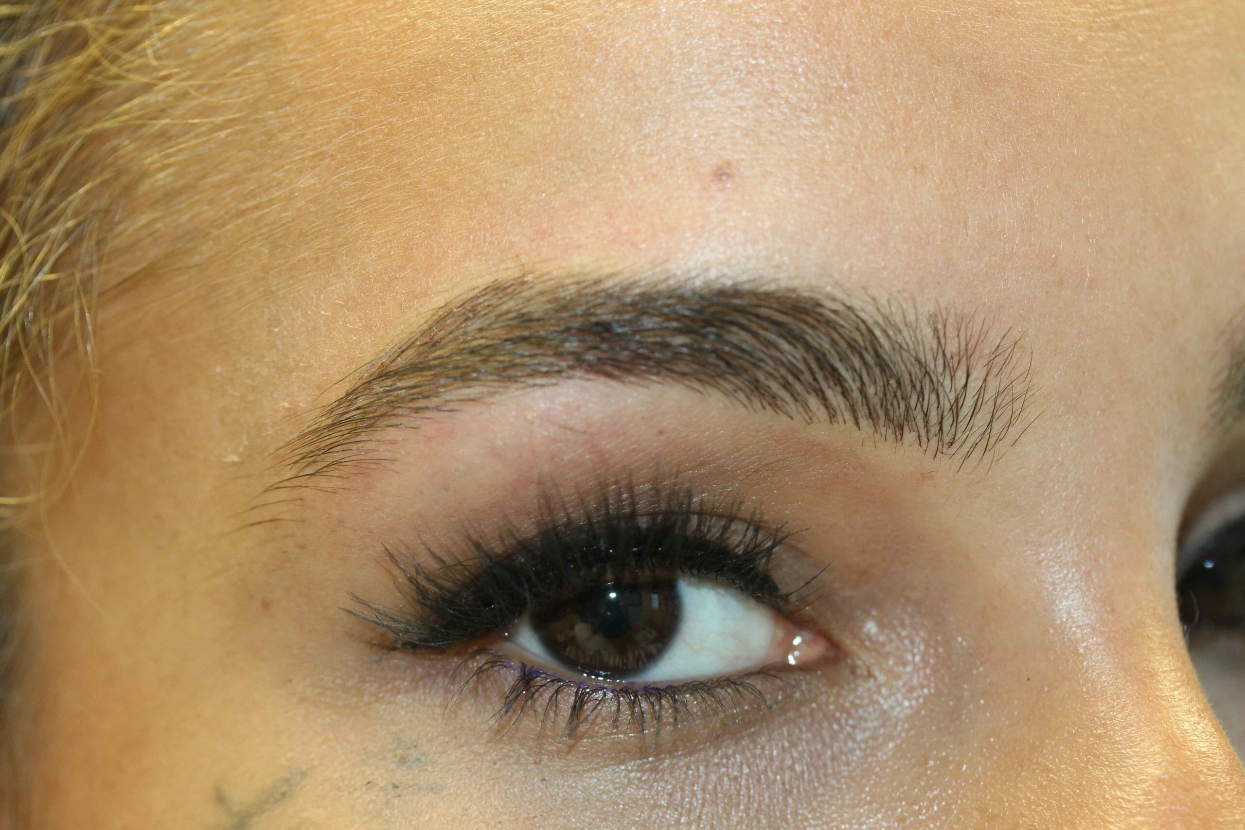After Eyebrow Angle Scaled Picture