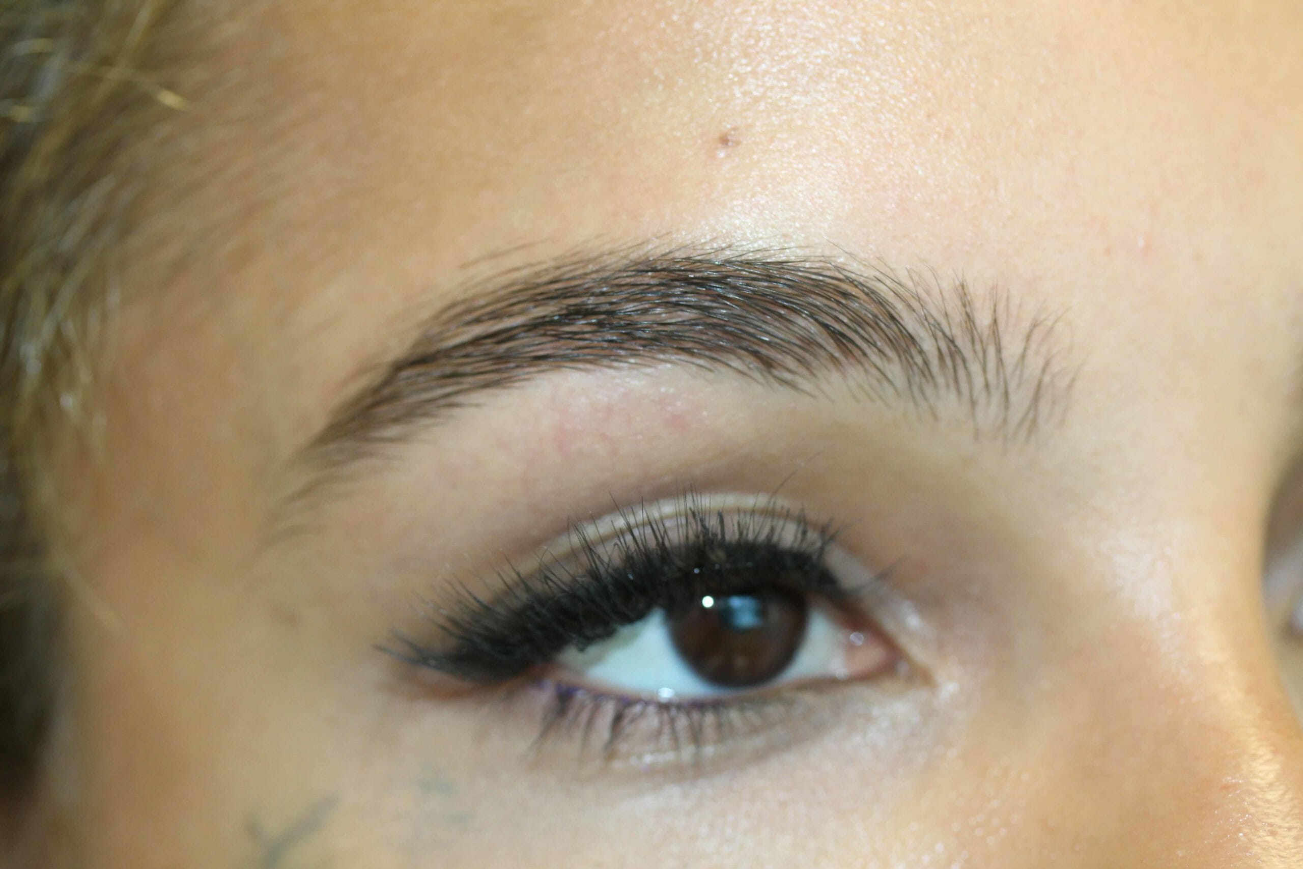 Eyebrow Before Angle Scaled Photo