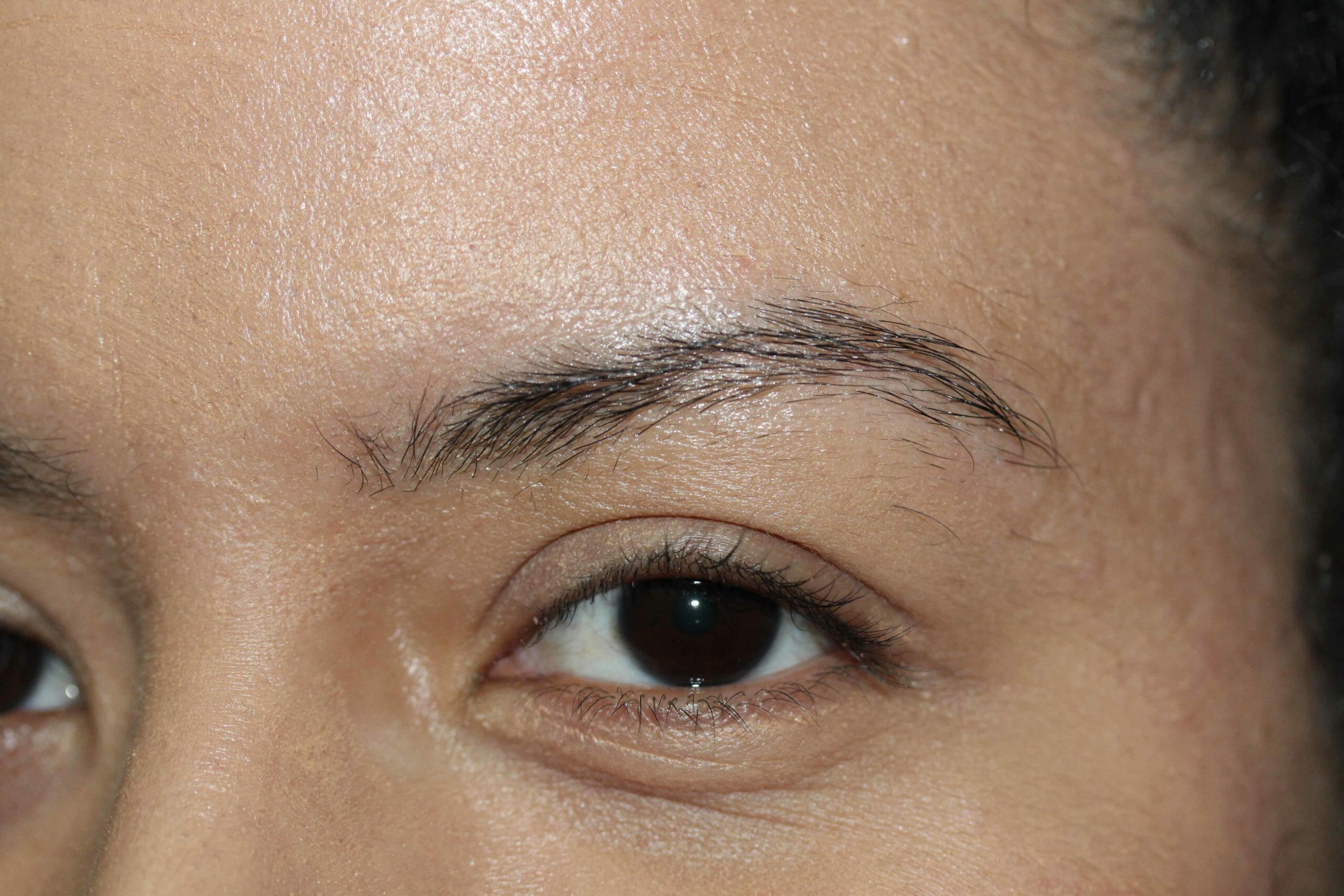 Eyebrow Before Angle 2 Scaled