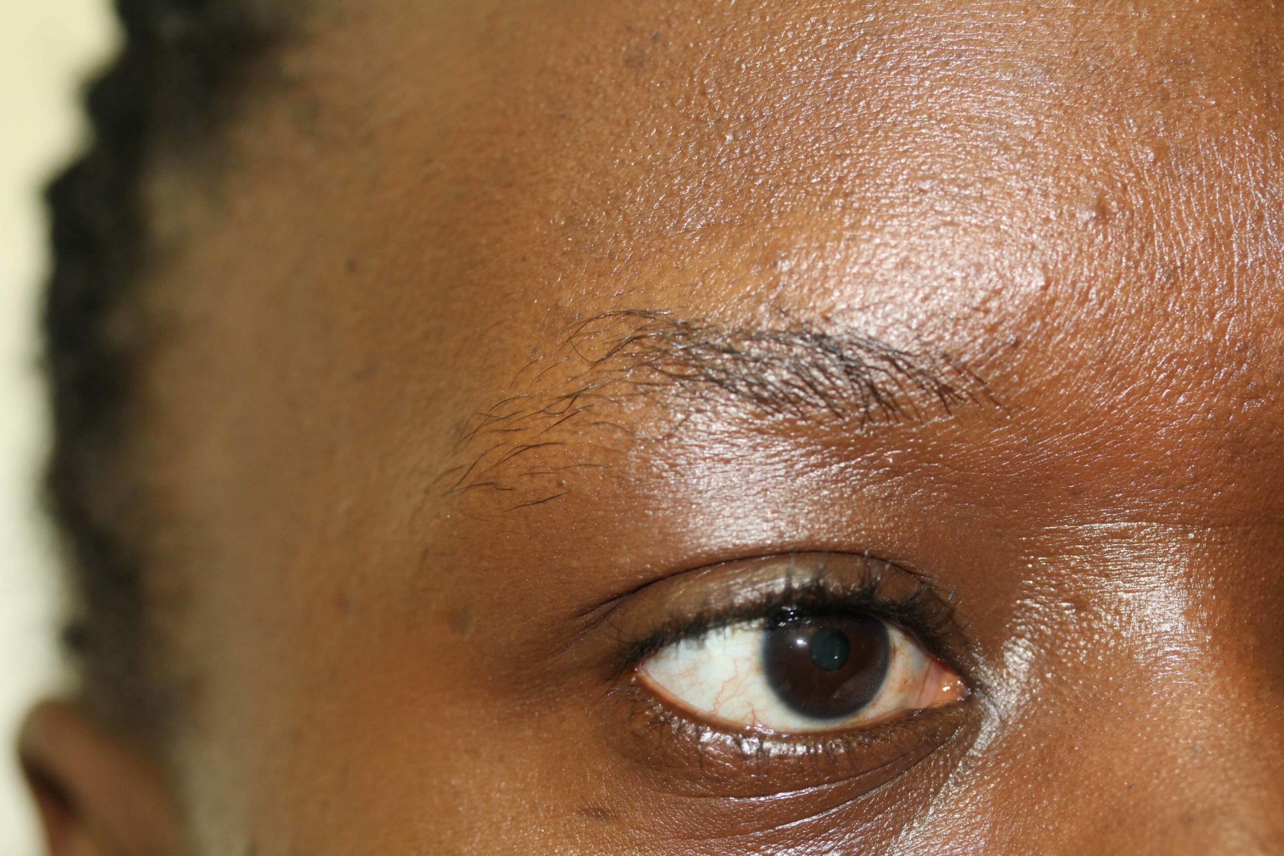 Eyebrow Before Scaled