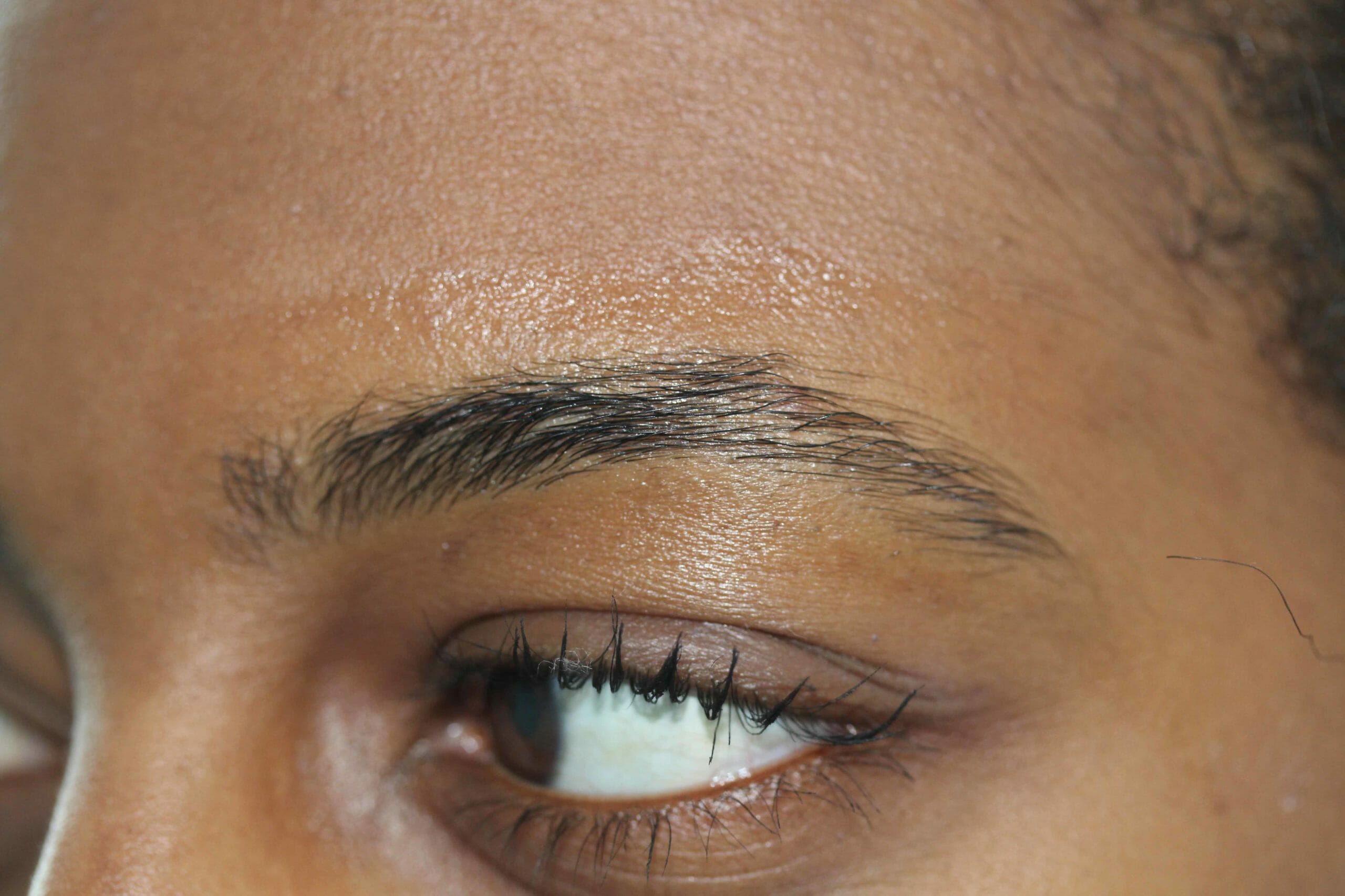 Eyebrow Before Angle Scale Image