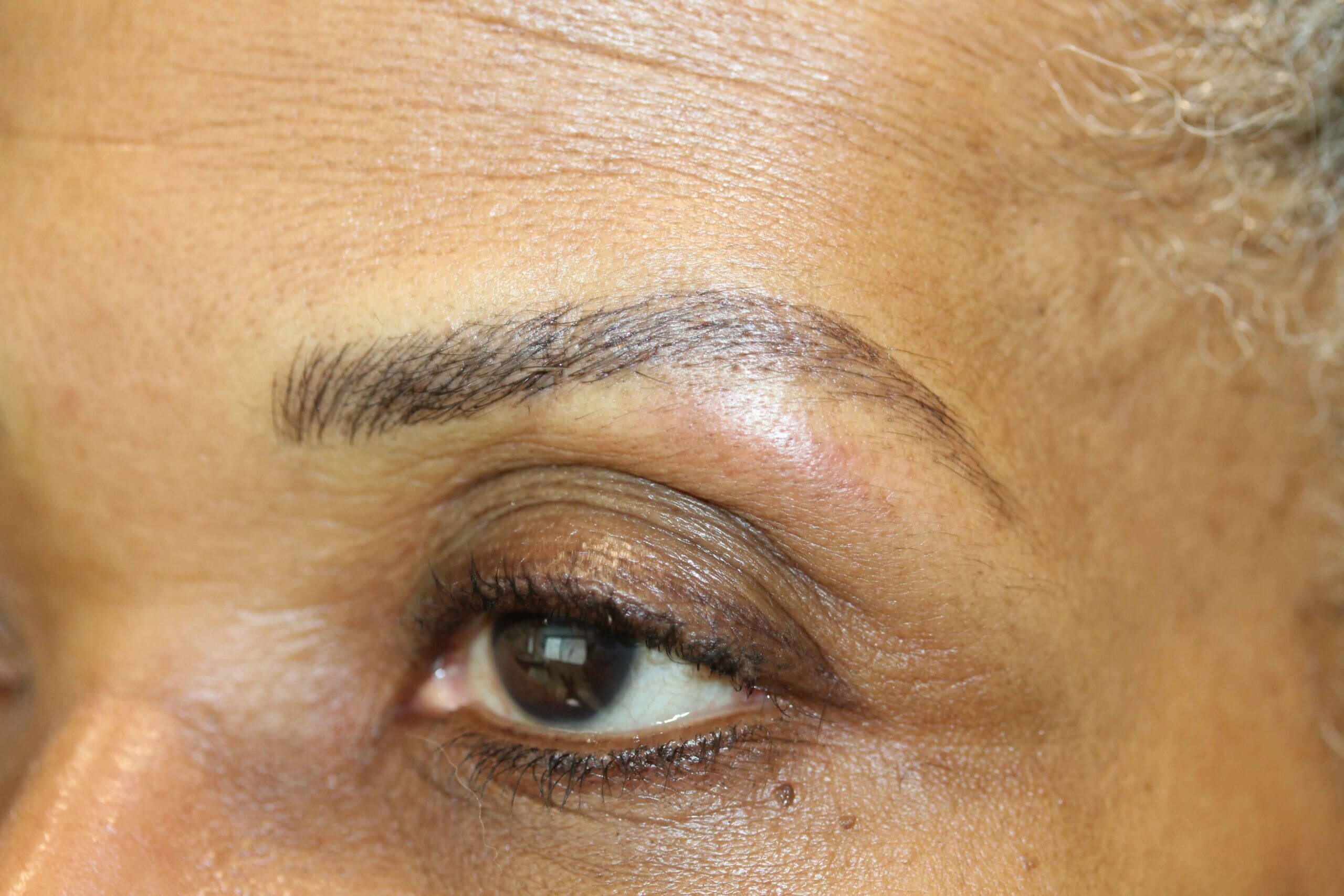 Eyebrow After scaled