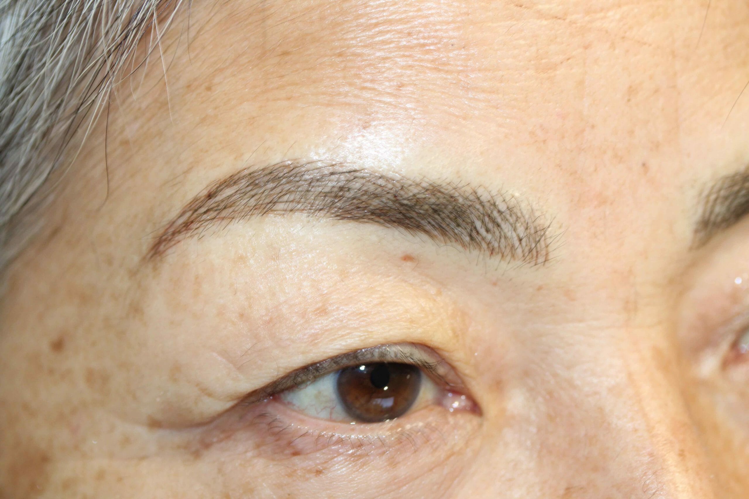Eyebrow After