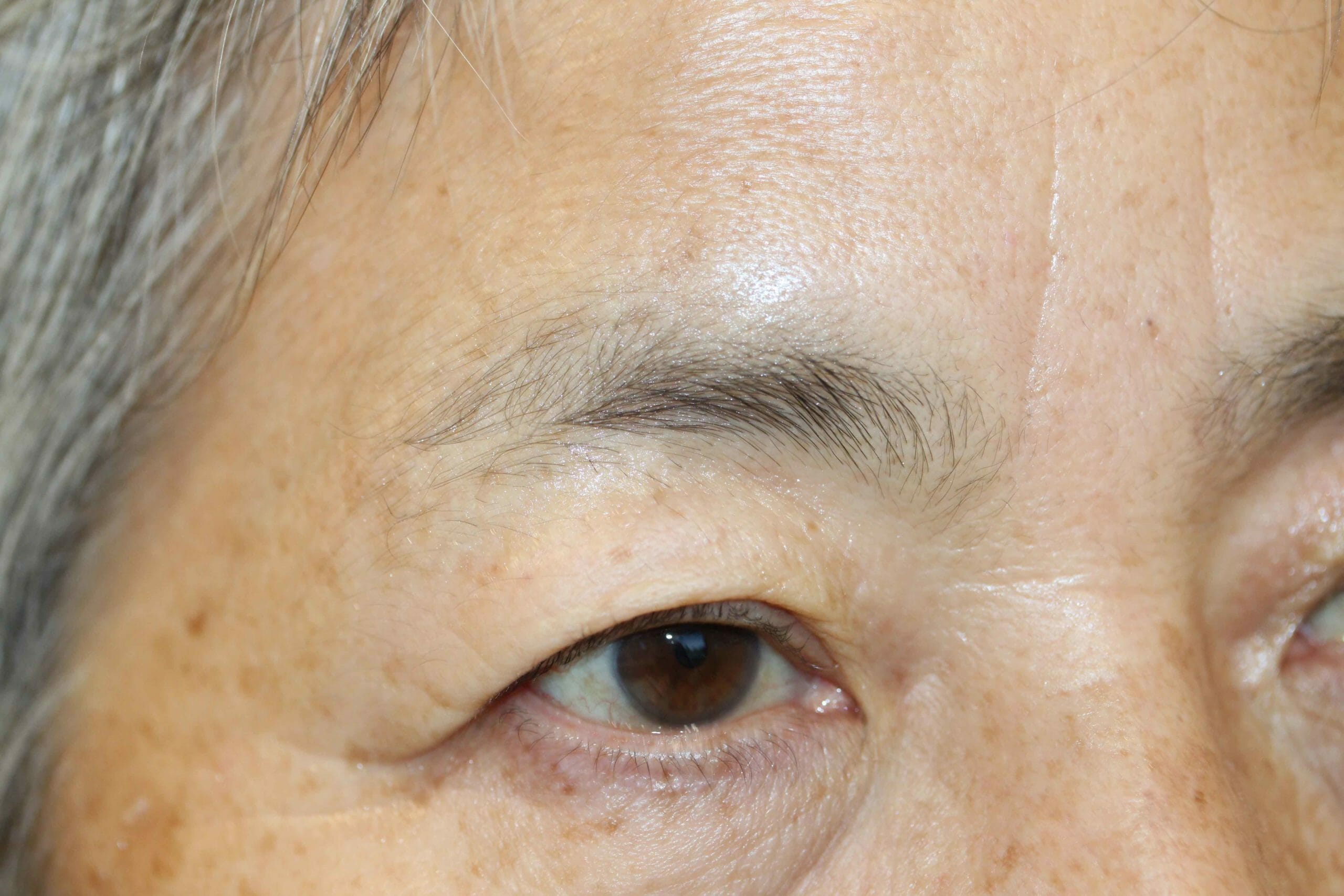 Eyebrow Before Scaled