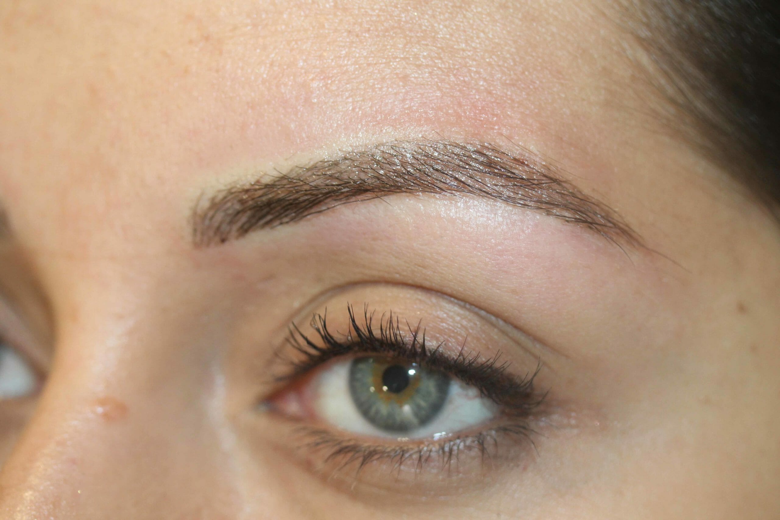 Eyebrow After Scaled