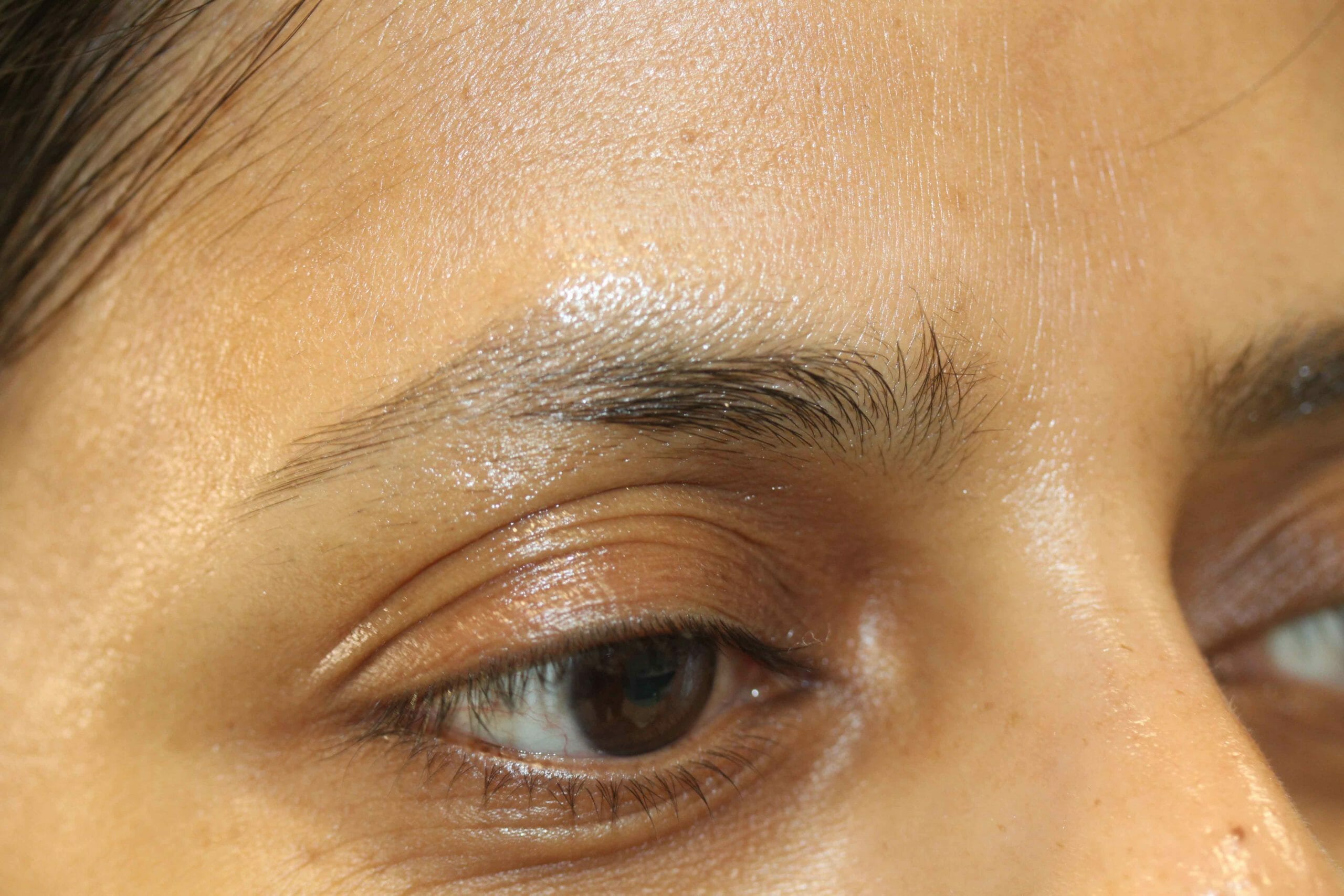 Eyebrow Before scaled