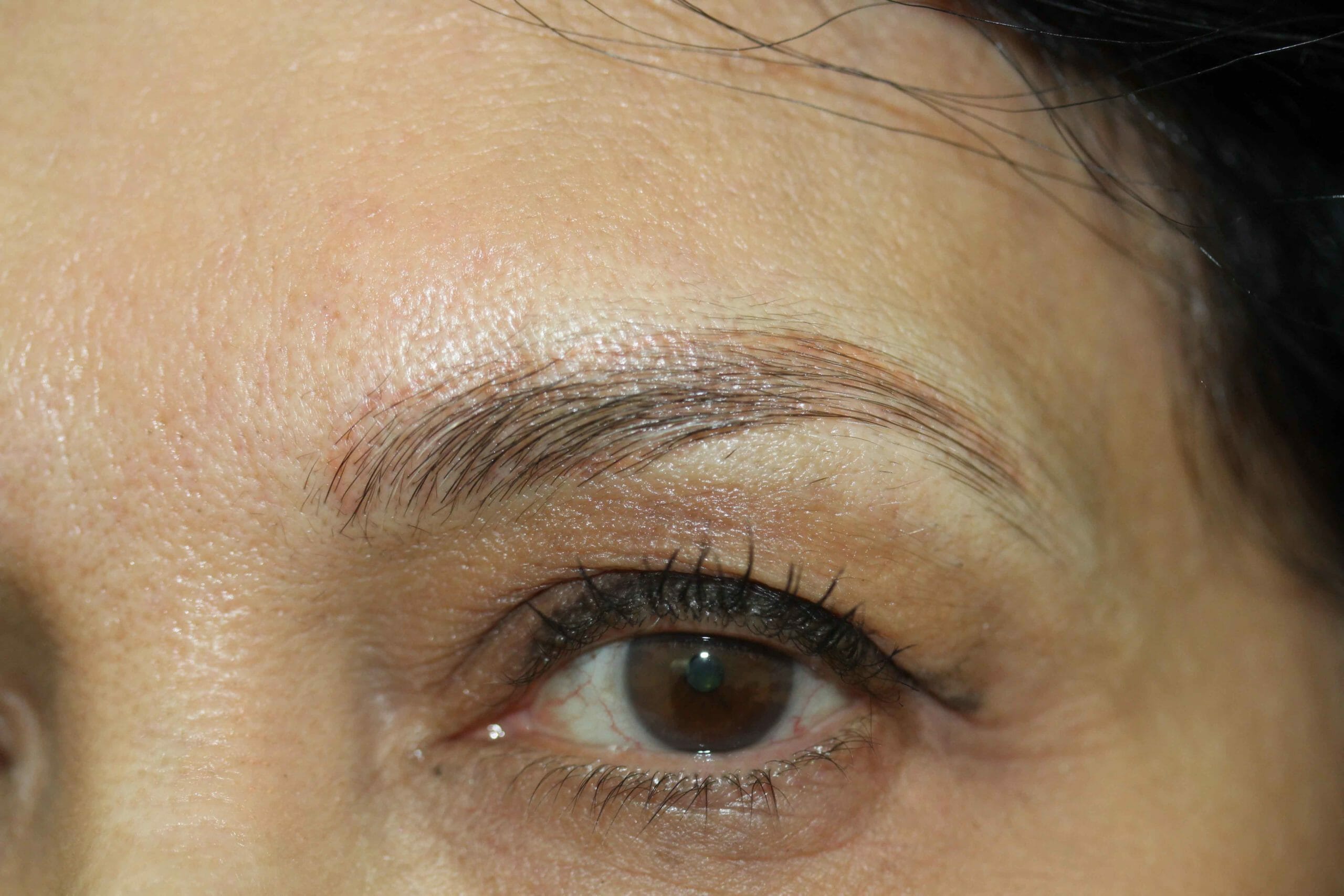 Eyebrow Before Scaled Photo