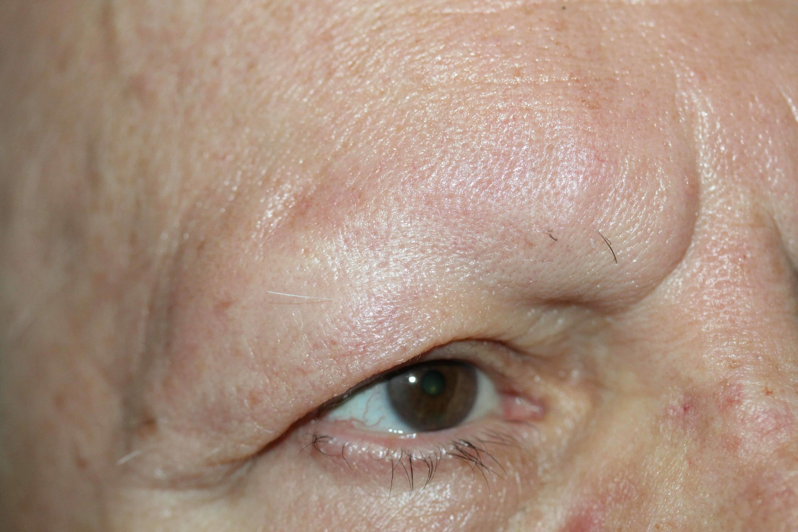 permanent eyebrows