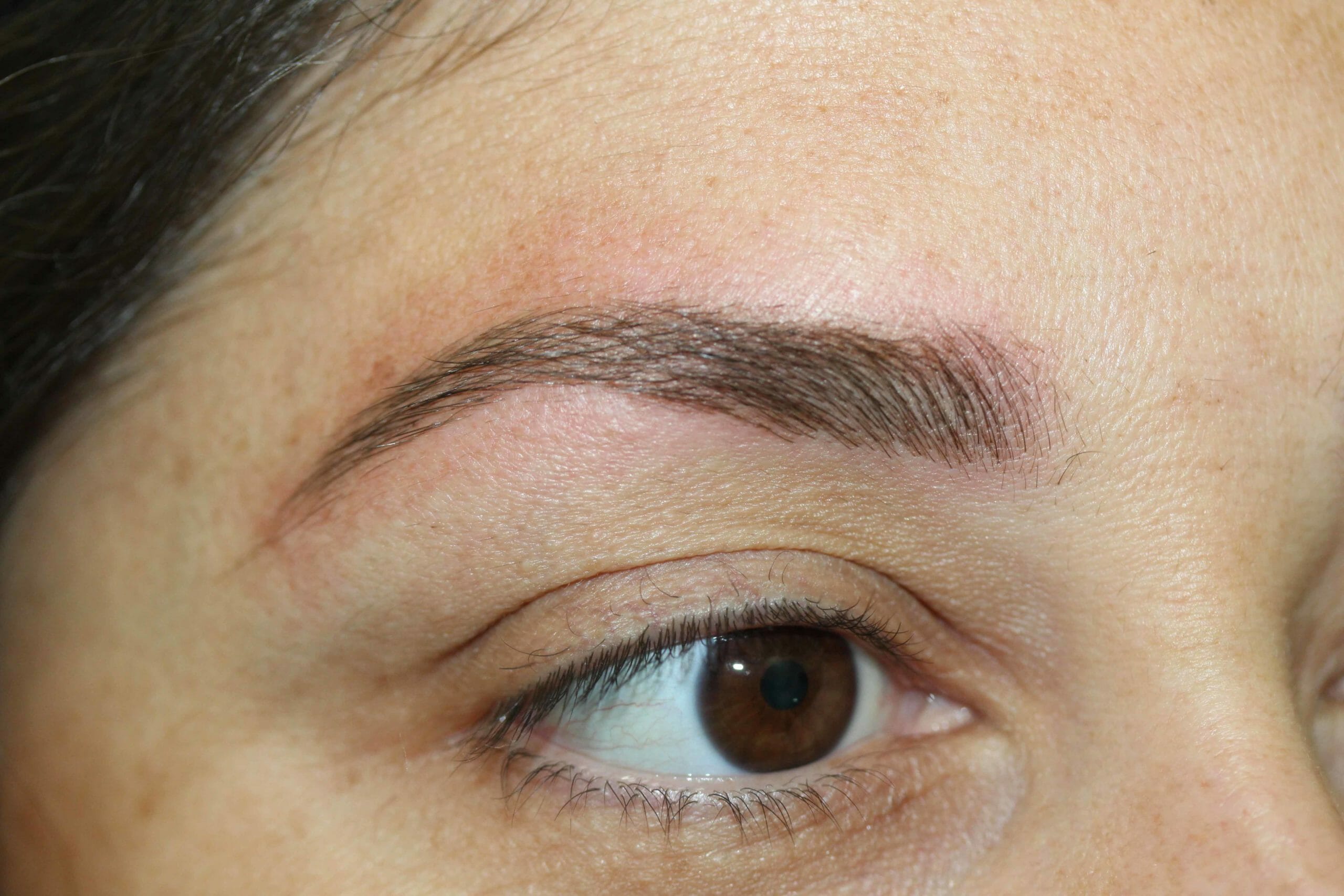 Eyebrow After Scaled