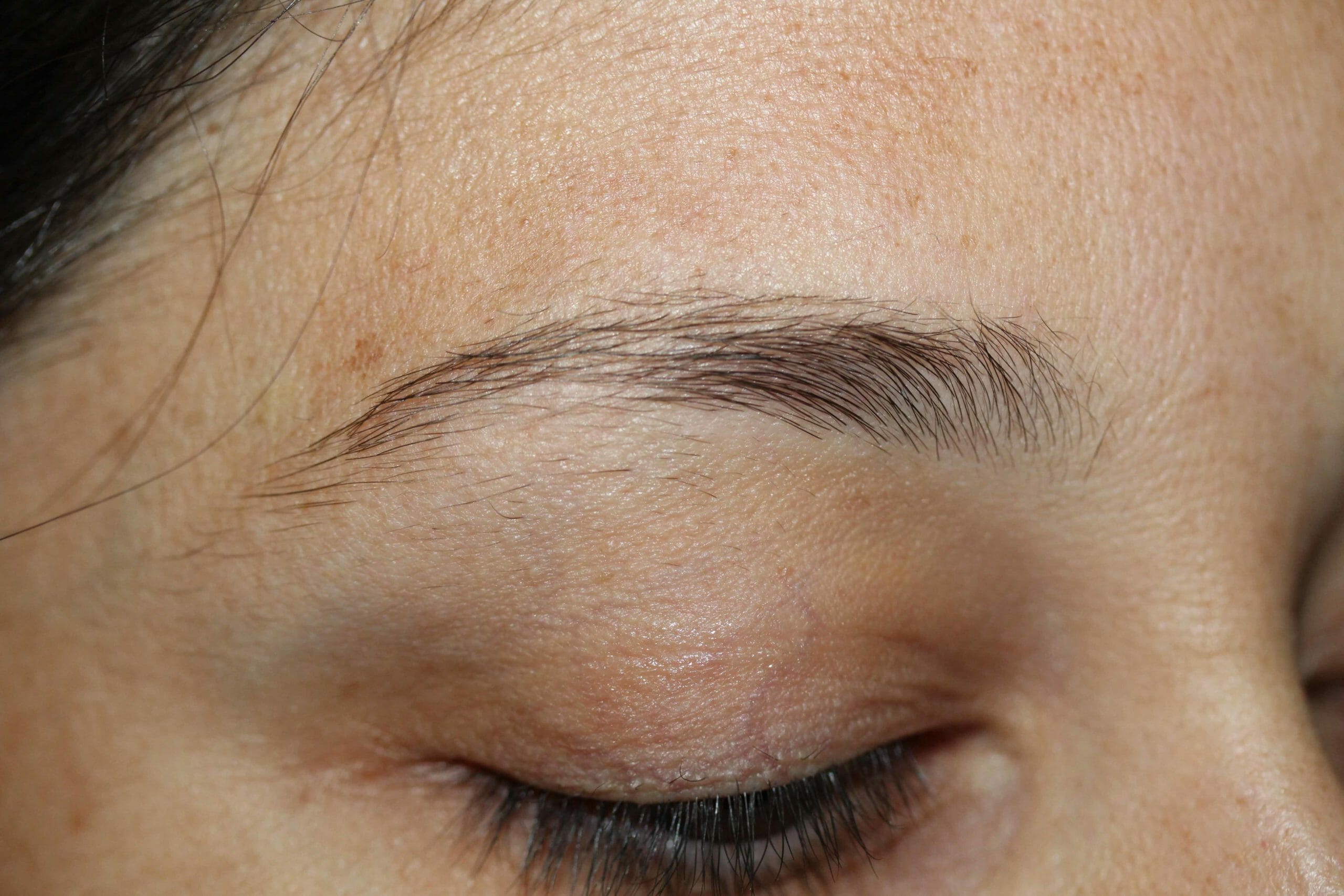 Eyebrow Before