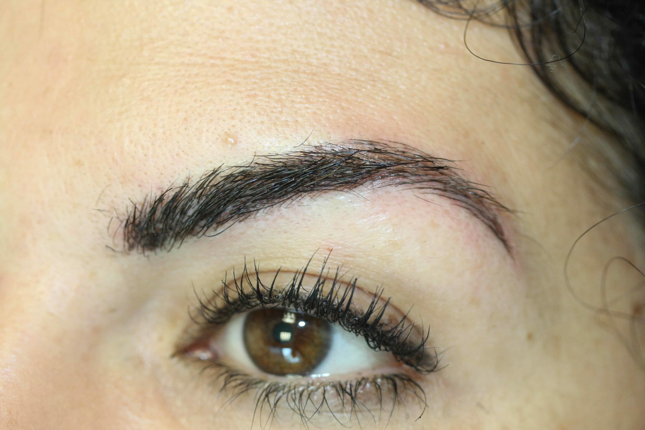 Eyebrow After Scaled