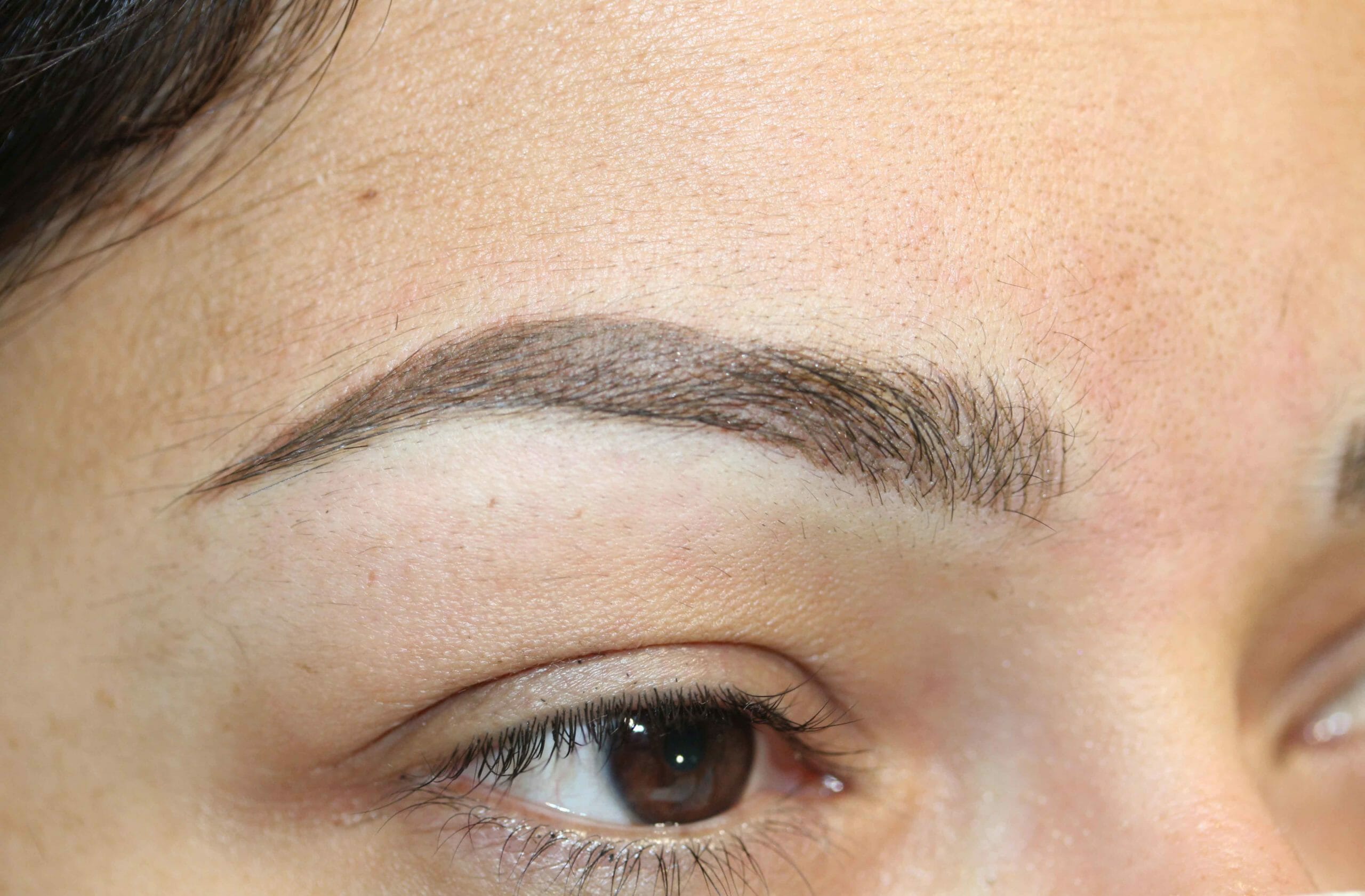 Eyebrows After Scaled