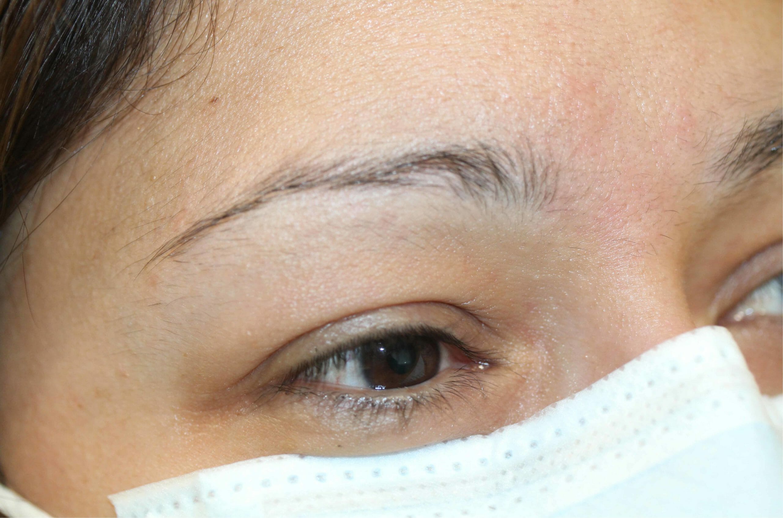 Eyebrows Before Scaled
