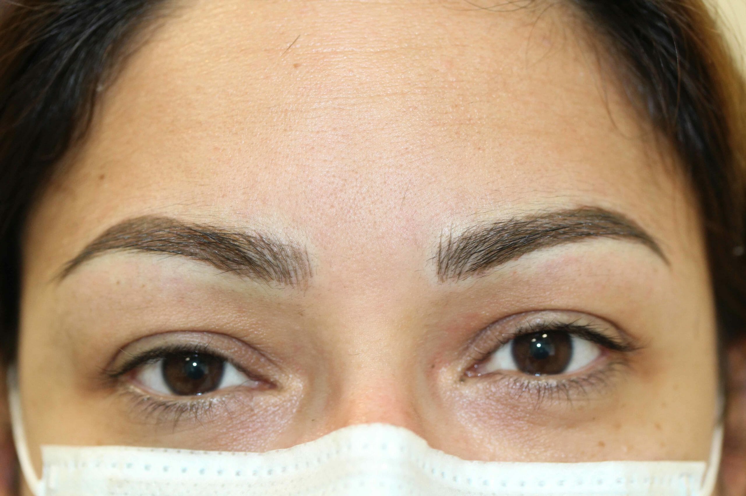 Eyebrows After Scaled