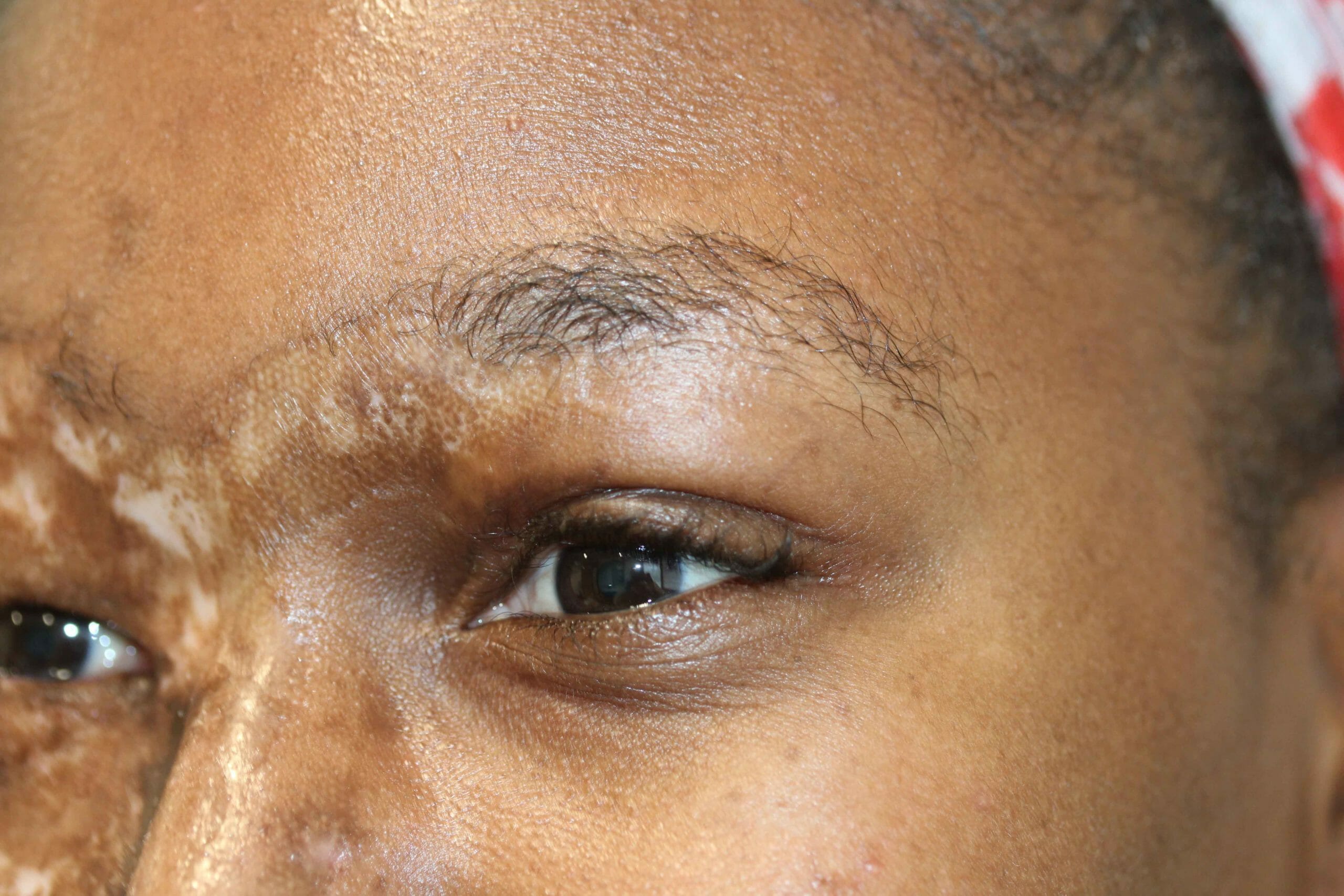 eyebrows 25 before Eyebrows Before Scaled