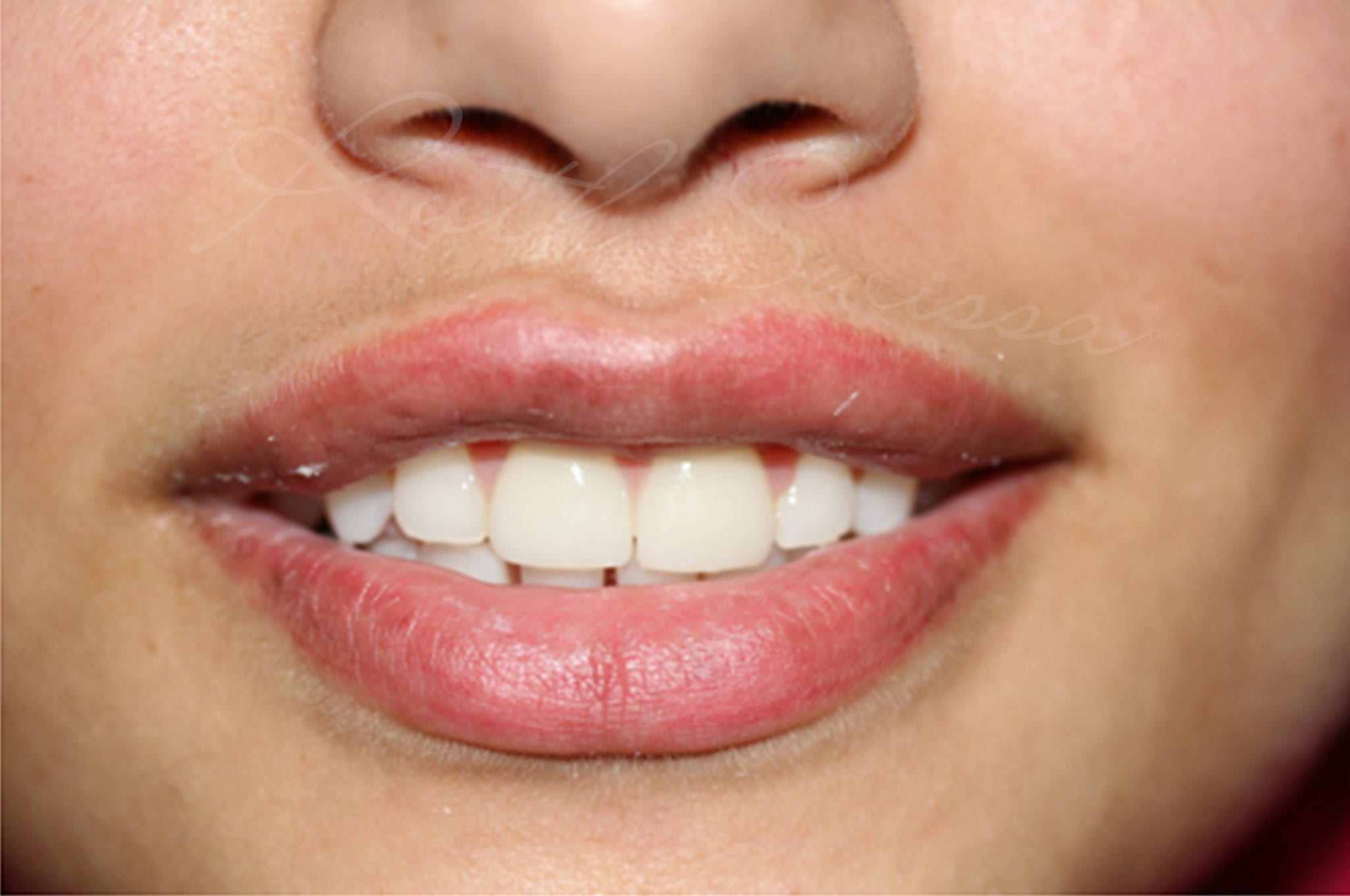 Lip Blush