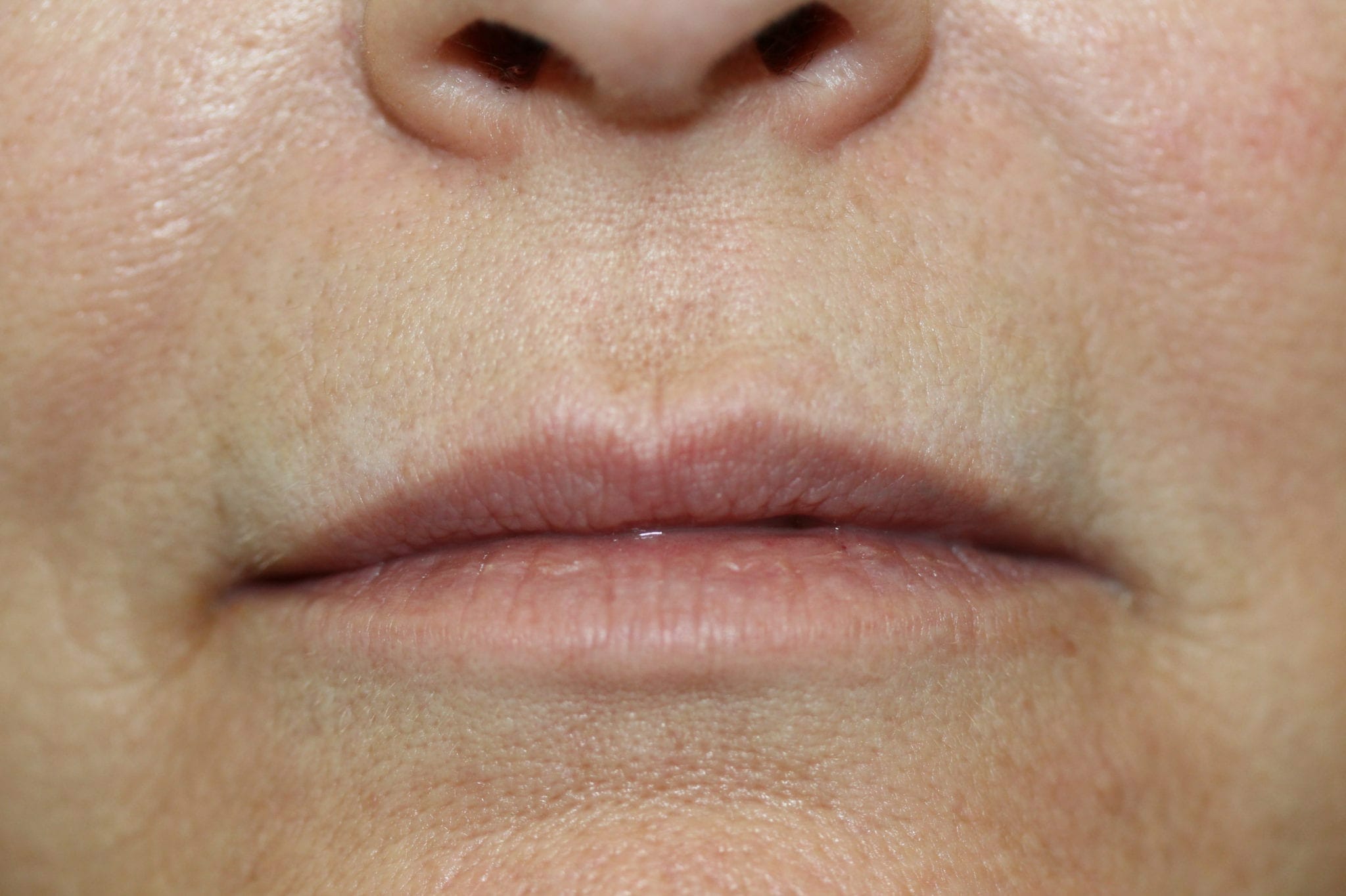 Permanent Lip liner & Color before & after