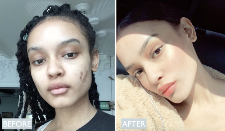 permanent makeup ruth swissa before and after