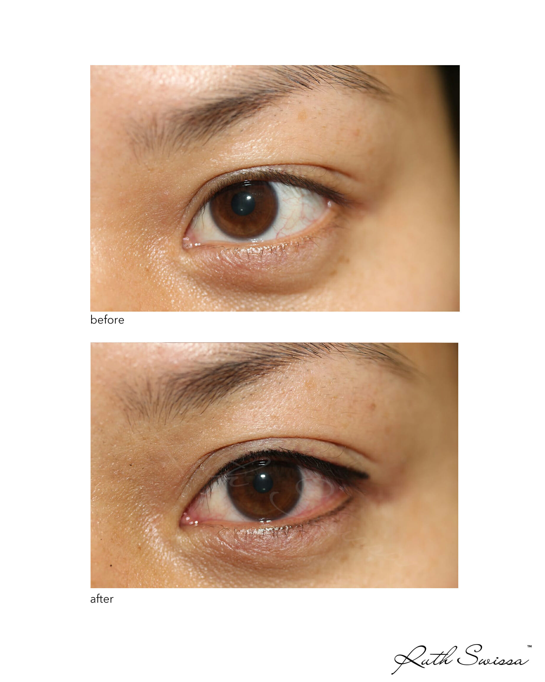 permanent eyebrows
