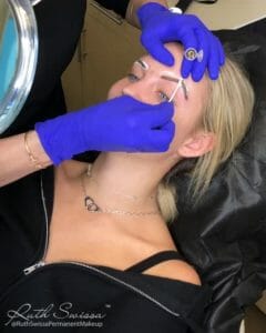 microneedling under eyes