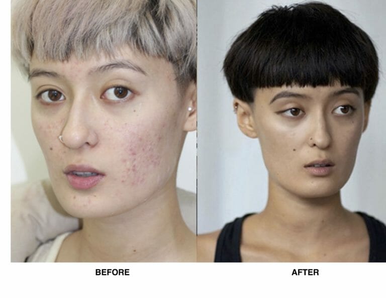 before and after ruth swissa