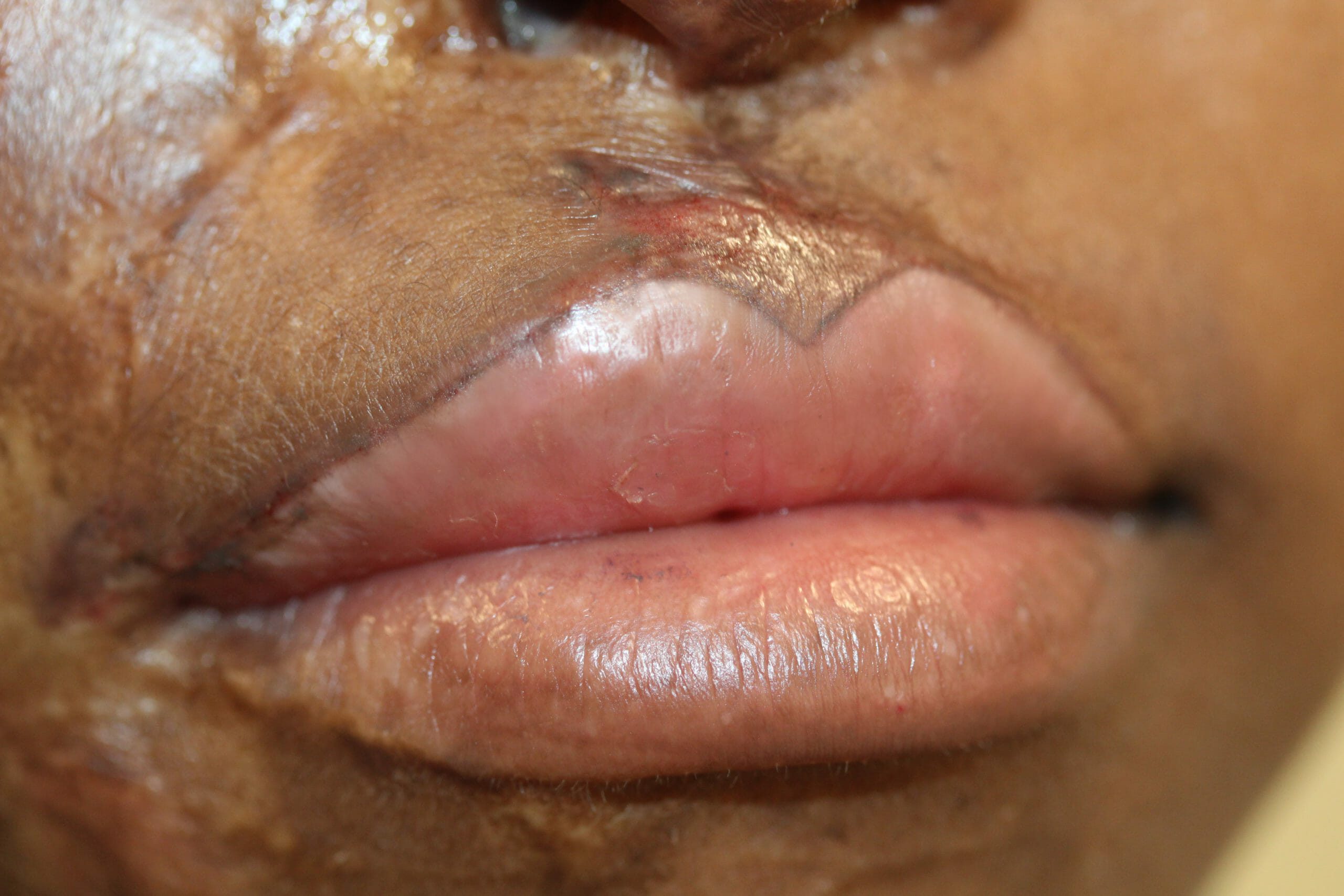 Lips 8 after permanent makeup lips