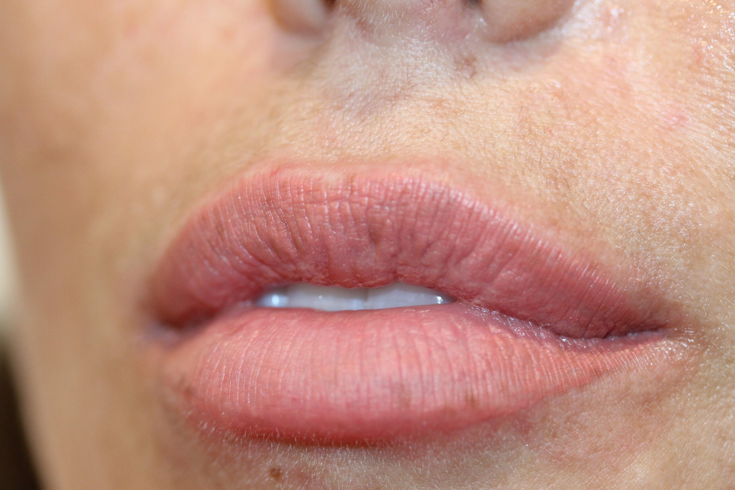 permanent lipstick before and after at ruth swissa med spa