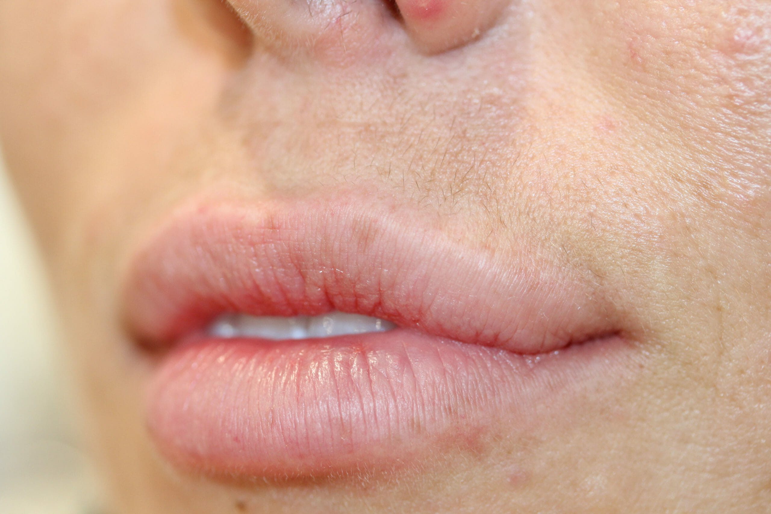 permanent lipstick before and after at ruth swissa
