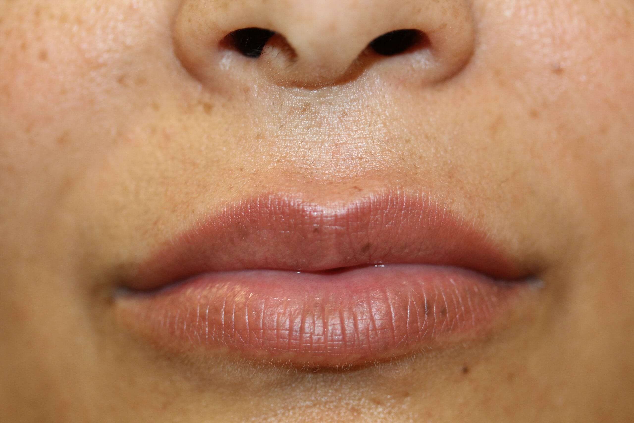 permanent lipstick before and after ruth swissa medical spa