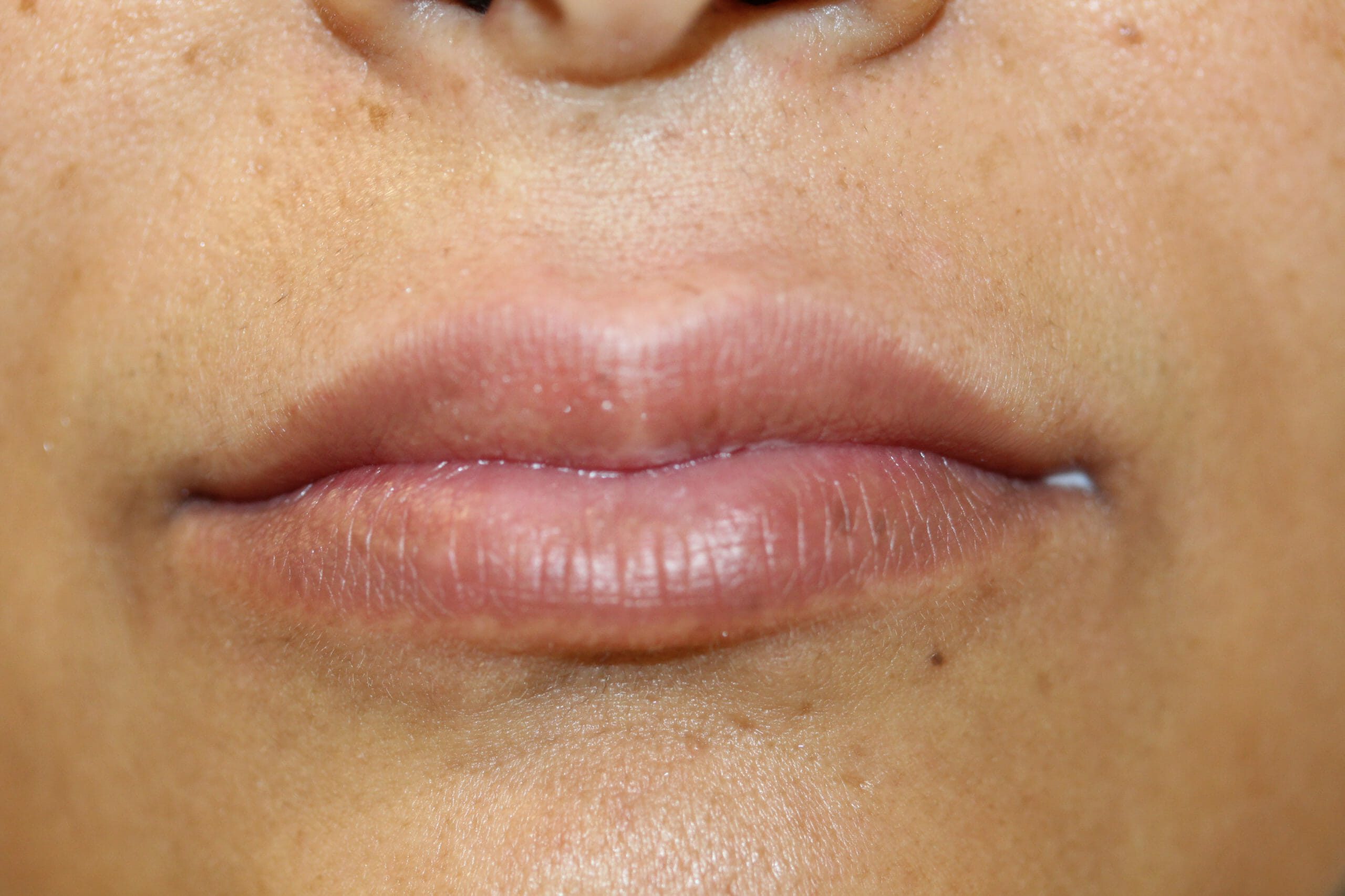 permanent lipstick before and after at ruth swissa medical spa