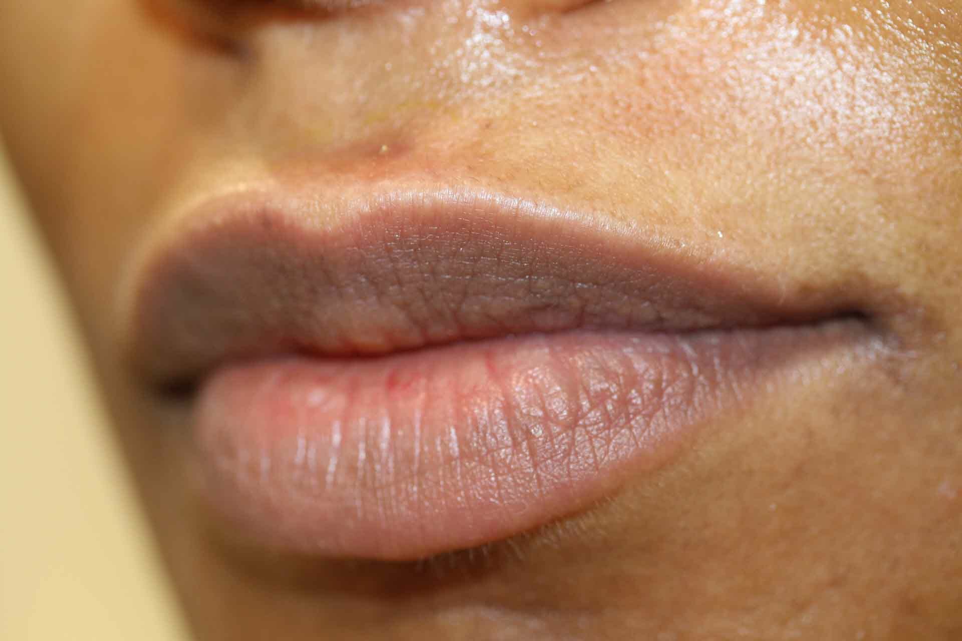 ruth swissa medical spa permanent lipstick tattoo
